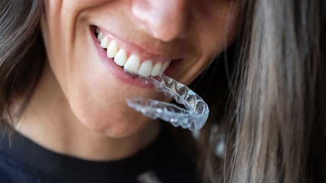 precio-invisalign-madrid-leganes