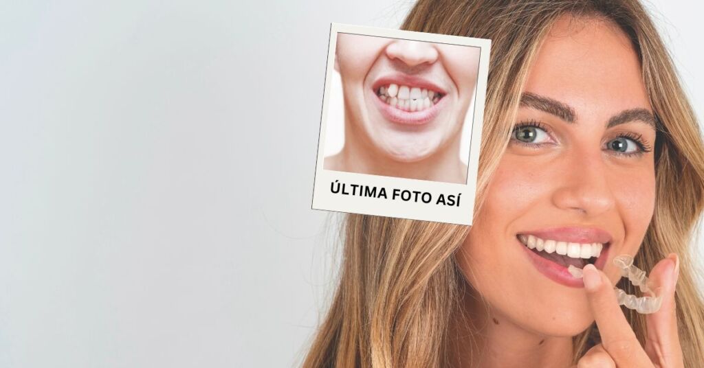 Open Day Invisalign: ¡La Oportunidad Perfecta para tu Nueva Sonrisa en Arroyomolinos!